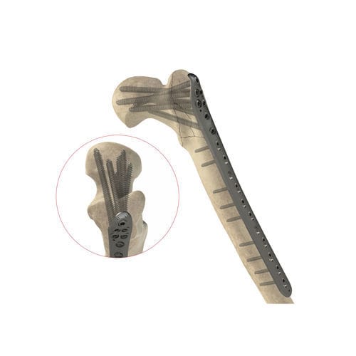 Placca di compressione femorale - Ases Orthopedics - prossimale / bloccata