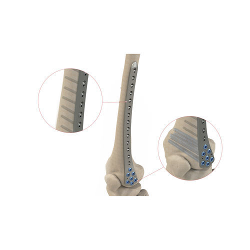 Placca di compressione per cotile femorale - Ases Orthopedics - distale / bloccata