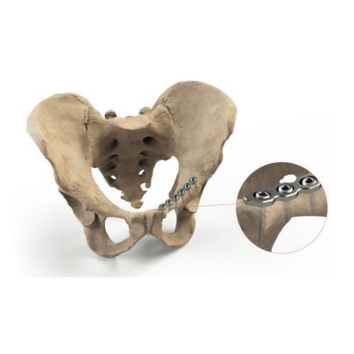 Placca di compressione per bacino - Ases Orthopedics - bloccata