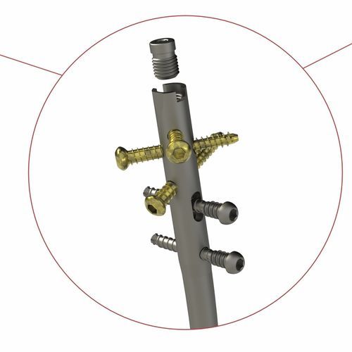 Chiodo intramidollare per tibia - 4T1-4011000 - Ases Orthopedics