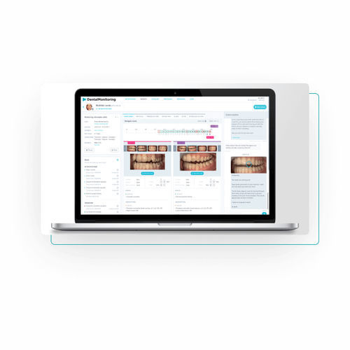 Piattaforma AI odontoiatrica - Dental Monitoring - di analisi delle immagini / di trattamento / di acquisizione