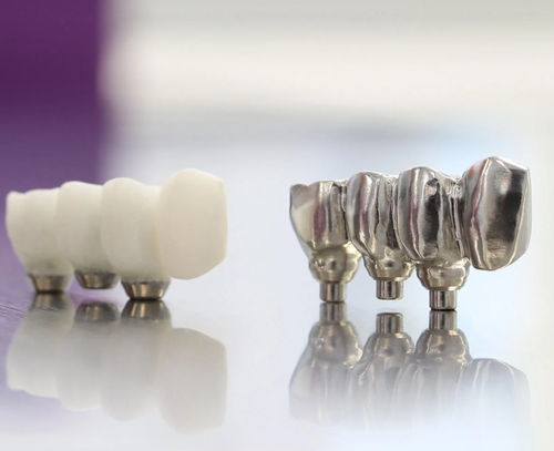 Ponte dentale in titanio - Copywax - Panthera Dental - CoCr / in acrilico / in zircone