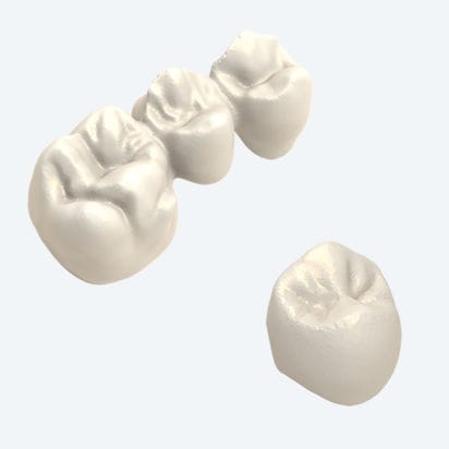 Protesi dentale in PMMA - NEW ANCORVIS S.r.l - in composito / in zircone / CoCr