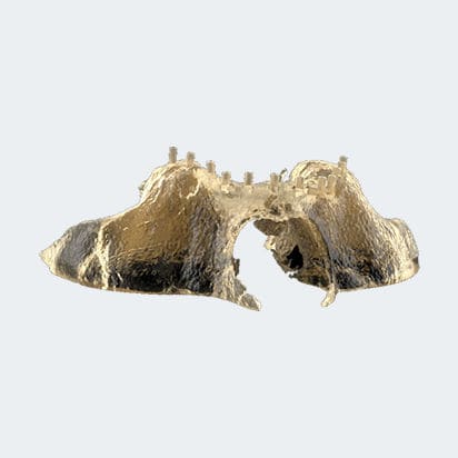 Modello anatomico osseo - NEW ANCORVIS S.r.l - per chirurgia / didattico / di valutazione