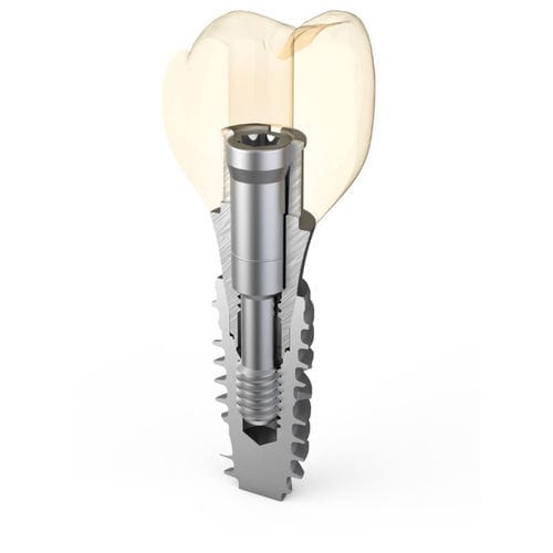 Pilastro dentale per impianto in titanio - Master Fix - ARUM DENTISTRY Co., Ltd. - esterno / angolare / a vite