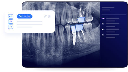 Software per implantologia dentale - Allisone - Allisone Technologies - per chirurgia odontoiatrica / per radiografia / di visualizzazione