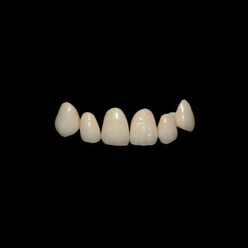Corona dentale in zircone - Shenzhen Alcadent Co.Ltd Alcadent Dental Laboratory - incisivo superiore / per denti posteriori