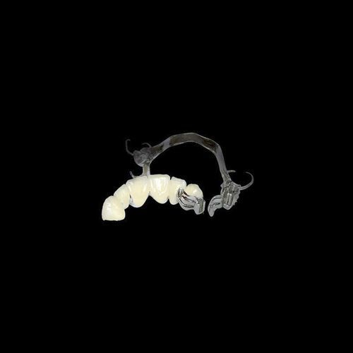 Ponte dentale in ceramica - Shenzhen Alcadent Co.Ltd Alcadent Dental Laboratory - incisivo inferiore / amovibile