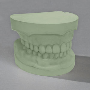 Materiale odontoiatrico in pietra - Glastone® 3000 die - Ransom & Randolph - per ponti dentali / per corone dentali