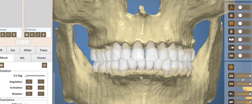 Software odontoiatrico - OrthoAnalysis - Inteware Co., Ltd - di analisi / di trattamento / di pianificazione del trattamento