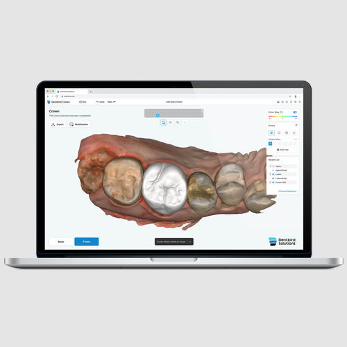 Software di progettazione - Dentbird Crown - Imagoworks Inc. - CAD / di acquisizione / di masterizzazione