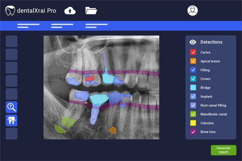 Software di analisi - dentalXrai Pro 3.0 - dentalXrai GmbH - di valutazione / medico / odontoiatrico