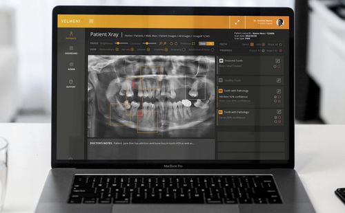 Piattaforma AI per diagnostica per immagini - Second Dentist ™ - VELMENI - per il settore medico / odontoiatrica / di analisi