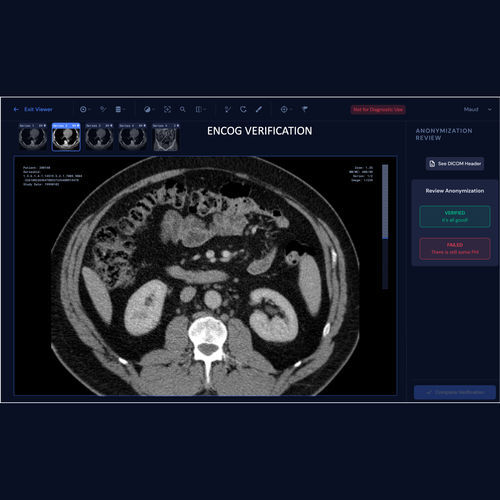 Applicazione web di gestione dati - ENCOG™ - Enlitic - di tracciabilità dei dati / medica / per tomografia computerizzata