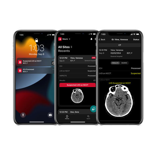 Applicazione mobile per diagnosi di ictus - NCCT - RapidAI - di analisi delle immagini / medica / per tomografia computerizzata