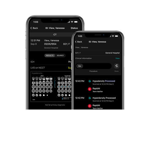 Applicazione mobile di trattamento - RapidAI - di condivisione / per diagnosi di ictus / medica