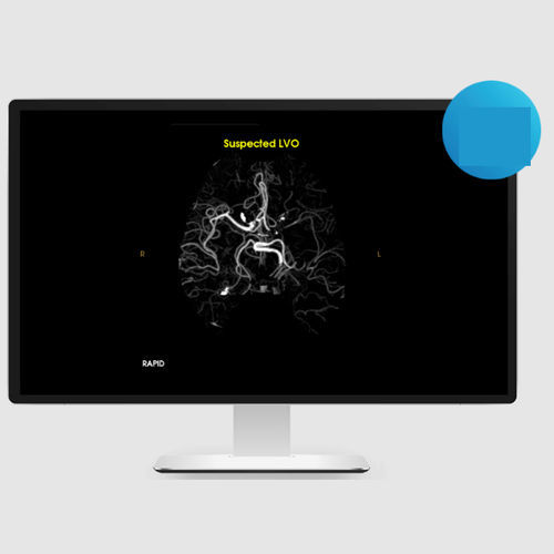 Software per diagnosi di ictus - LVO - RapidAI - di validazione / medico / di carotide interna