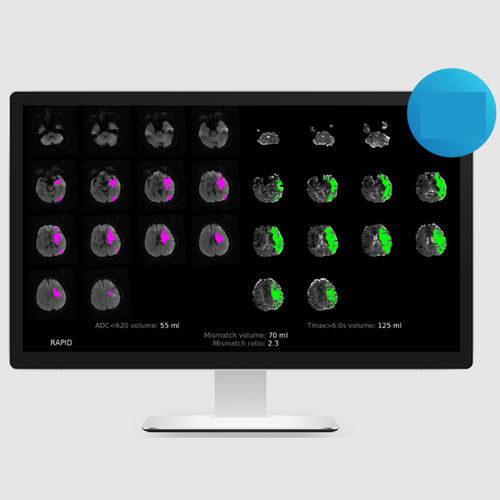 Software medico - MRI - RapidAI - clinico / di analisi delle immagini / di acquisizione