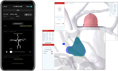 Applicazione mobile di gestione - RapidAI - di trattamento / per diagnosi di ictus / con sistema di tracciatura