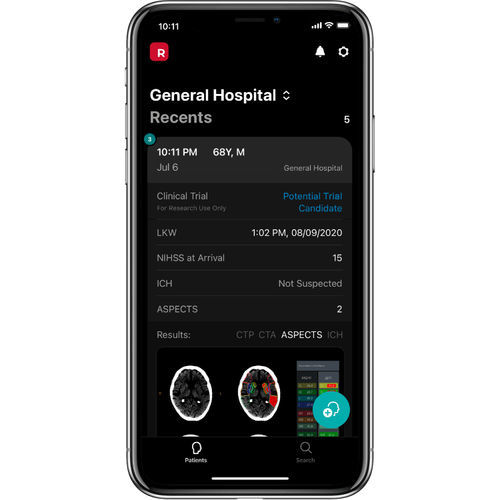 Applicazione mobile di gestione di sperimentazione clinica - RapidAI - medica / in tempo reale / con intelligenza artificiale