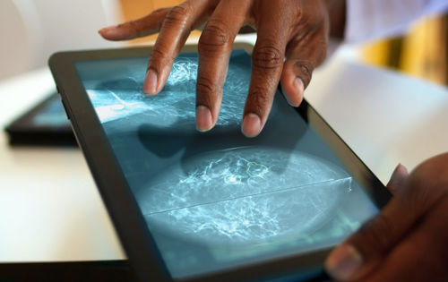 Piattaforma AI medica - Mia® Triage - Kheiron Medical Technologies - per screening del tumore al seno / di gestione