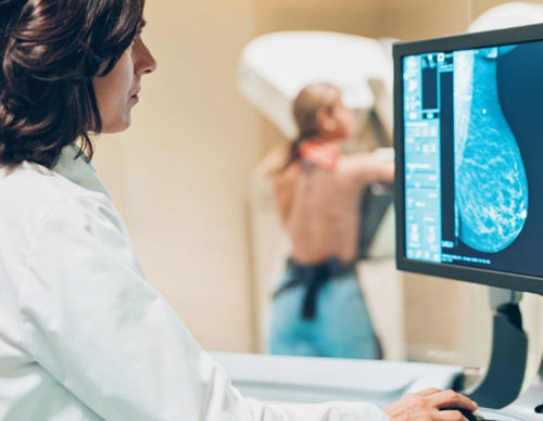 Piattaforma AI medica - Mia IQ™ - Kheiron Medical Technologies - di rilevamento / didattica