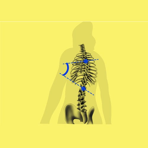 Software medico - BoneMetrics - Gleamer - clinico / di interpretazione / di standardizzazione