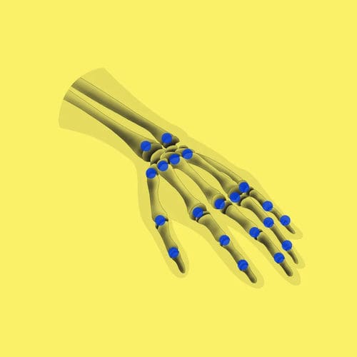 Software medico - BoneAge - Gleamer - clinico / pediatrico / osseo