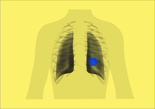 Software medico - ChestView - Gleamer - per tomografia computerizzata / di progettazione / di acquisizione