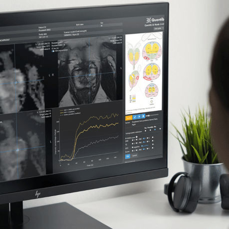 Software per radiologia - QUANTIB® - Quantib B.V. - di analisi delle immagini / di valutazione / di prostata