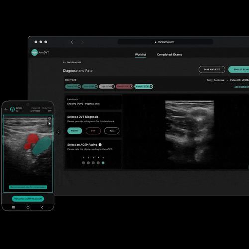 Software didattico - ThinkSono - per ecografia