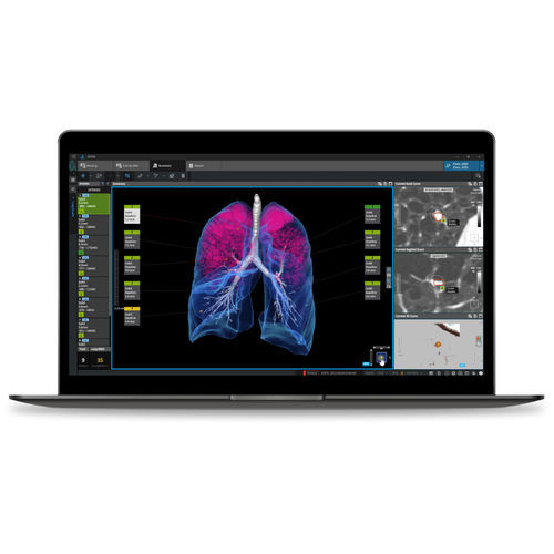 Software per screening del tumore del pomone - LCS  - Coreline - medico / per tomografia computerizzata / di analisi delle immagini