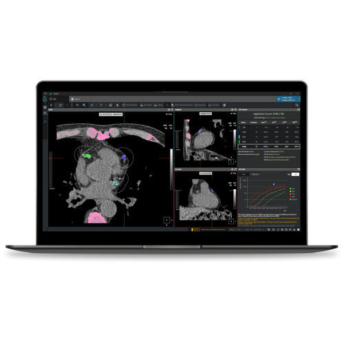 Software medico - CAC - Coreline - per tomografia computerizzata / cardiovascolare / di analisi