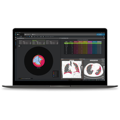 Software medico - Coreline - di analisi / per reportistica / di interpretazione