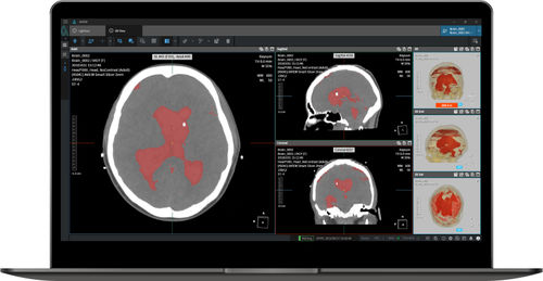 Software medico - NeuroCAD - Coreline - di emergenza / per tomografia computerizzata / di analisi
