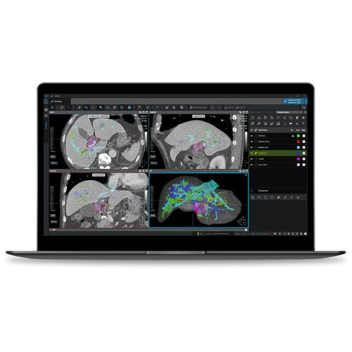 Software medico - Coreline - per tomografia computerizzata / di gestione dati / visualizzatore