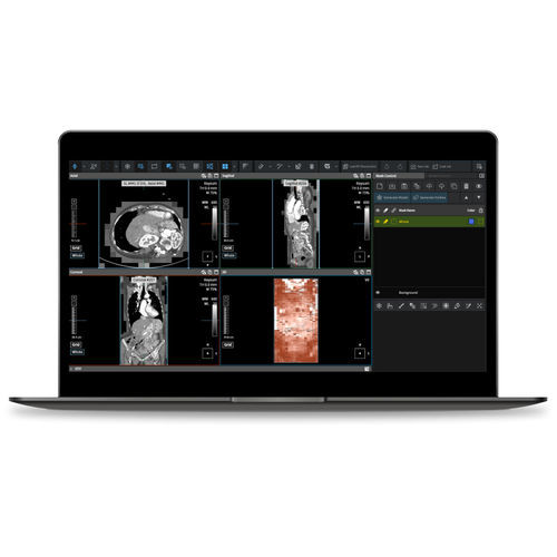 Software server - Coreline - medico / per tomografia computerizzata / MRI