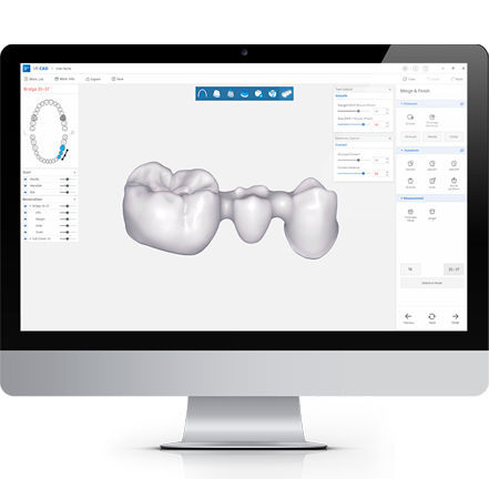 Software clinico - DESIGN+ - DDS Inc - odontoiatrico / di progettazione / CAD