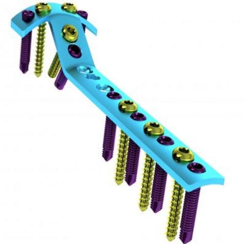 Placca di compressione per tibia - 5709-002-0 series - Ortobio - prossimale / bloccata / in titanio