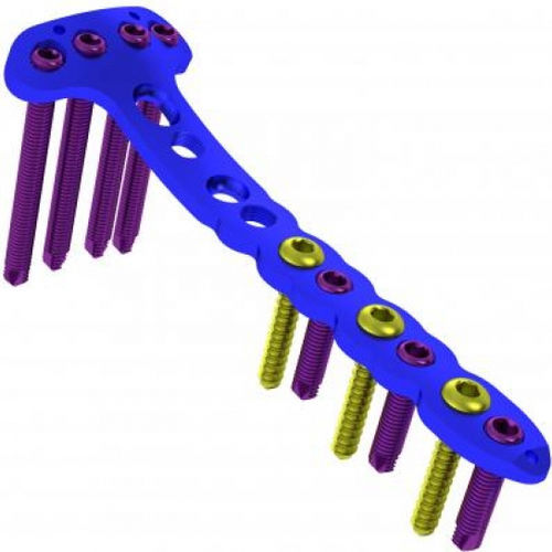 Placca di compressione per tibia - 5713-103 series - Ortobio - mediale / bloccata / in titanio