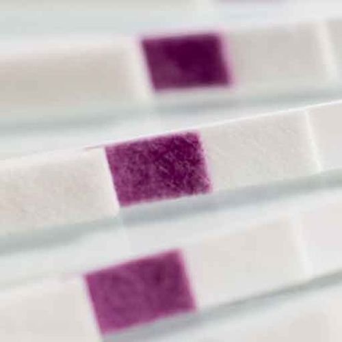 Striscia analitica per malattie renali - GBR-3409 - Golden BioTechnologies - di adenosina monofosfo / di urina / di superficie