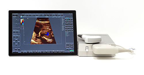 Ecografo portatile - SmartUs  - TELEMED - per ecografia multidisciplinare / in bianco e nero / con doppler a colori