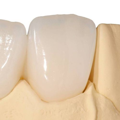 Materiale odontoiatrico in resina - P-PC - Shenzhen Purple Dance Technology Co., Ltd. - per corone dentali / per ricostruzione dentale / per stampa 3D