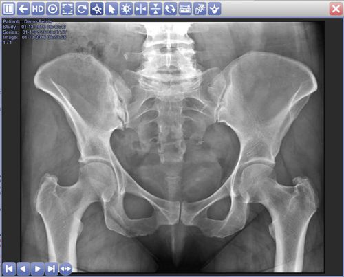 PACS con cloud computing - AccuVueCloud - Radmedix - per diagnostica per immagini