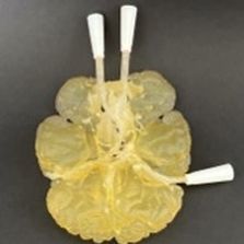 Modello anatomico del circolo arterioso di Willisii - AM20CW  - Samed - neurochirurgico / didattico / semitrasparente