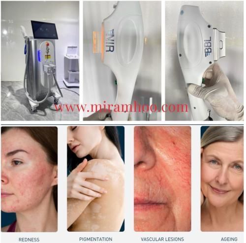 Sistema DPL per lesioni pigmentate - Dual Handle NIR DPL BBL Multi-Functional Aesthetic System - Miramhoo Aesthetics - per trattamento dell'acne / per ringiovanimento cutaneo / per epilazione
