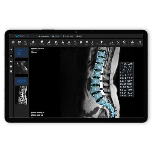 PACS per diagnostica per immagini - vpax.ai - voyance - basato sul web