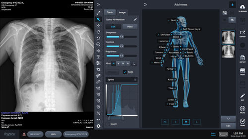 Software di controllo - voyance - di acquisizione / per radiografia / automatizzato