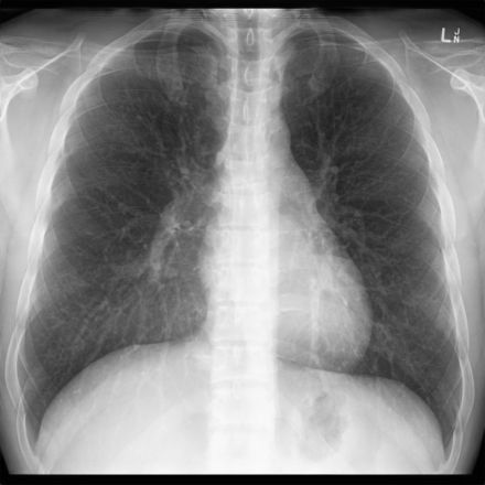Piattaforma AI per diagnostica per immagini - ClairVoyance - voyance - di analisi delle immagini / di ottimizzazione delle immagini / di misura