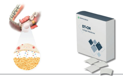Matrice tissutale chirurgia odontoiatrica - DT-CM - DENTAL TECH S.R.L. - collagene / assorbibile
